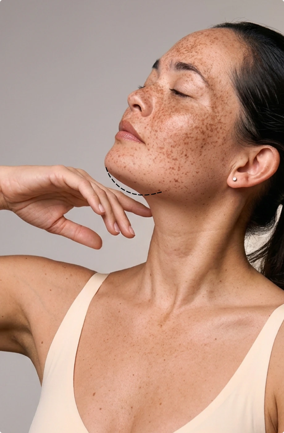 CLINICAL SCULPT - DOBLE MENTÓN